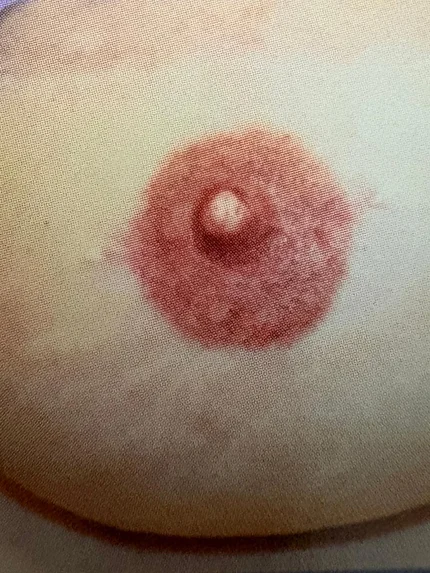 Survivorship 3D Breast Restoration and Coaching
