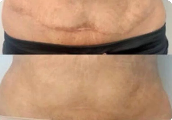 Non-Refundable Wellness Intake Consultation just for the 3D Areola Breast Reconstruction /  Cosmetic