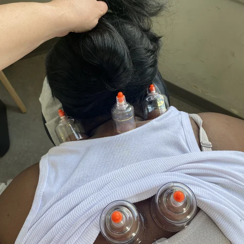 Cupping add on 