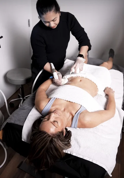 Body sculpting
