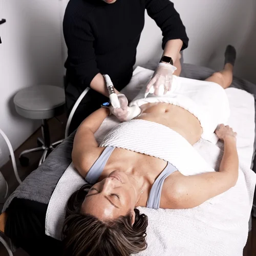 Body sculpting