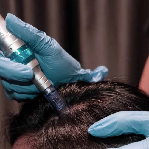 Hair Loss & Scalp Recovery Program