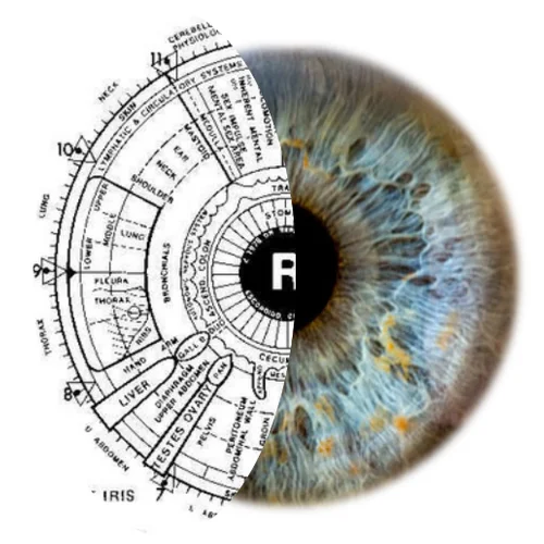 In-depth Written Iridology Analysis