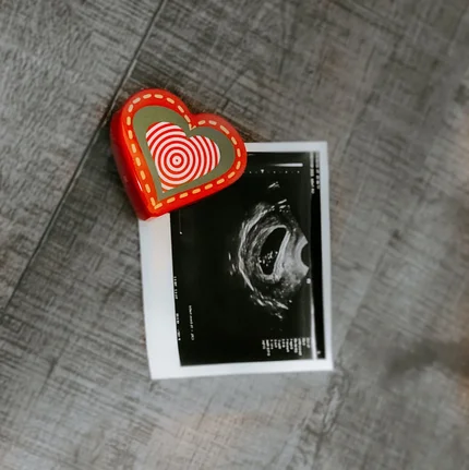 Pregnant After Loss Doula/Coach