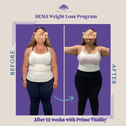 Physician-Led Medical Weight Loss (GLP-1)
