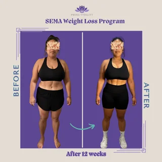 Physician-Led Medical Weight Loss (GLP-1)