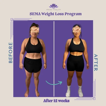 Physician-Led Medical Weight Loss (GLP-1)