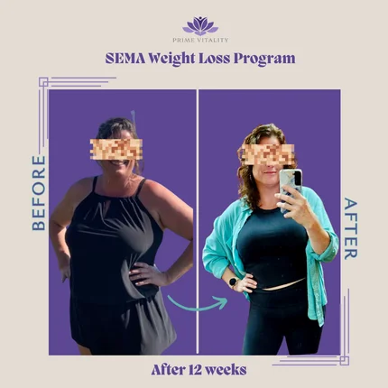 Physician-Led Medical Weight Loss (GLP-1)